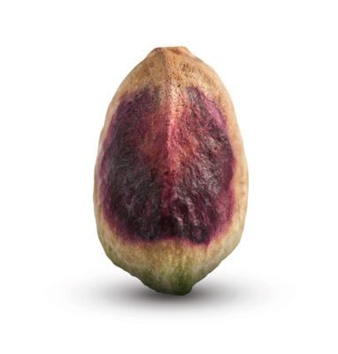 Normal Kernel